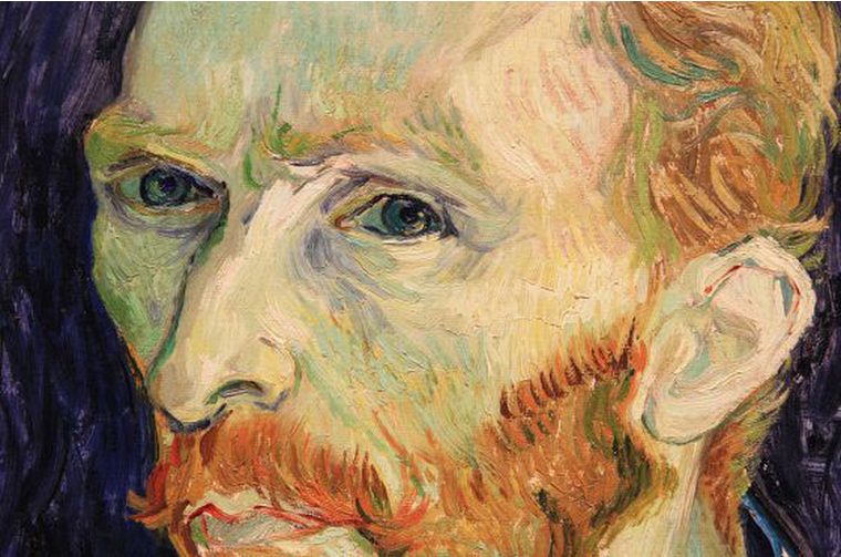 As doenças de Van Gogh